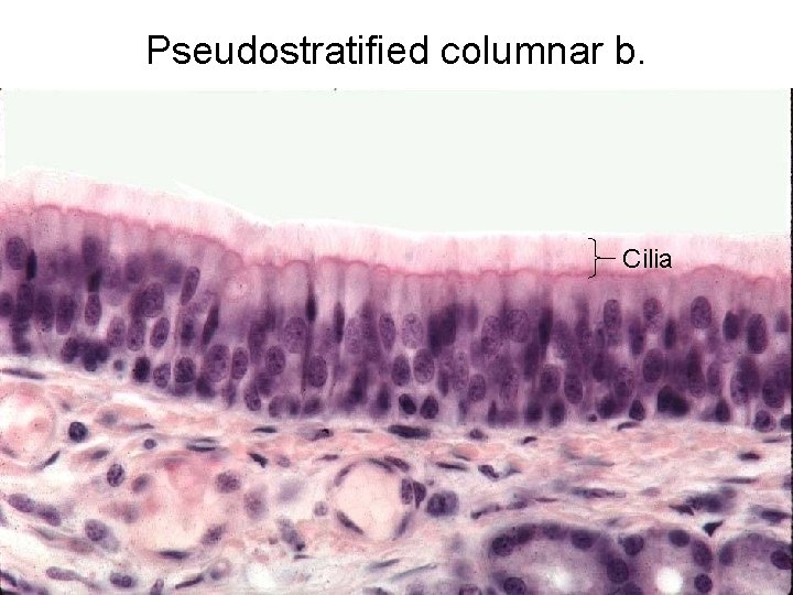 Pseudostratified columnar b. Cilia 