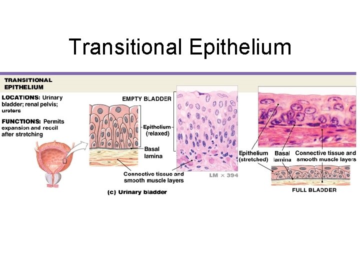 Transitional Epithelium 