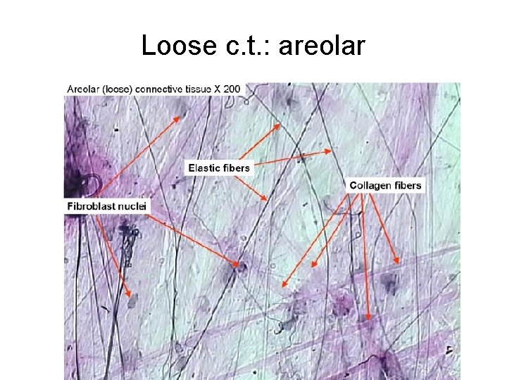 Loose c. t. : areolar 