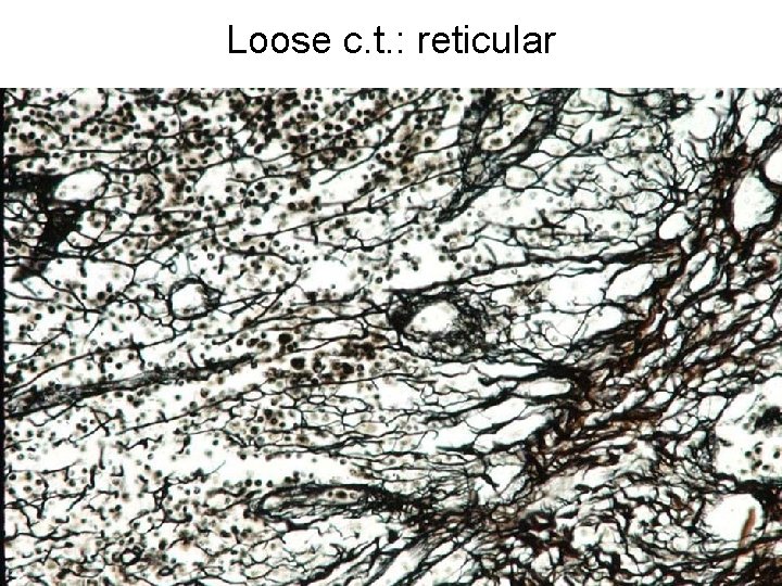 Loose c. t. : reticular 