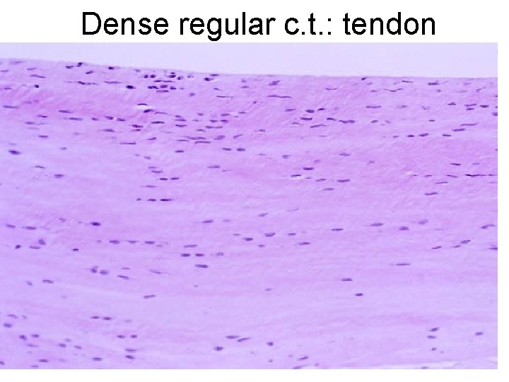 Dense regular c. t. : tendon 