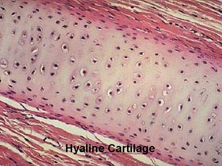 Hyaline Cartilage 