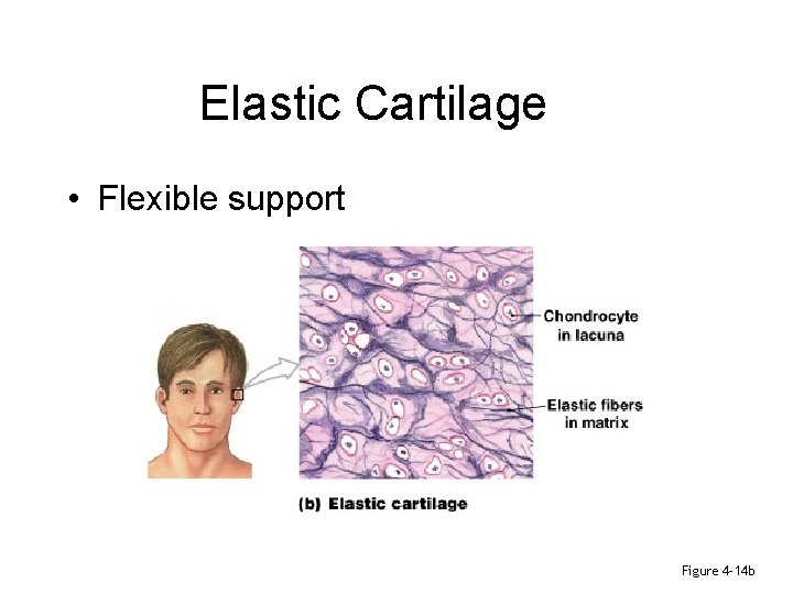 Elastic Cartilage • Flexible support Figure 4– 14 b 