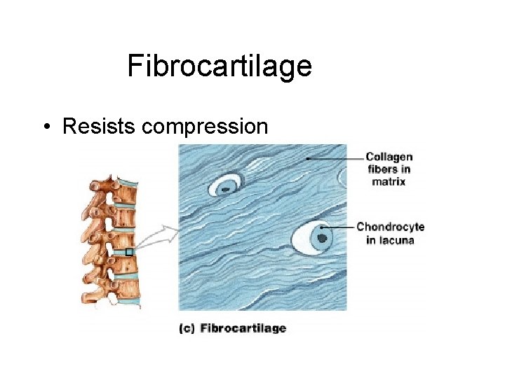 Fibrocartilage • Resists compression 