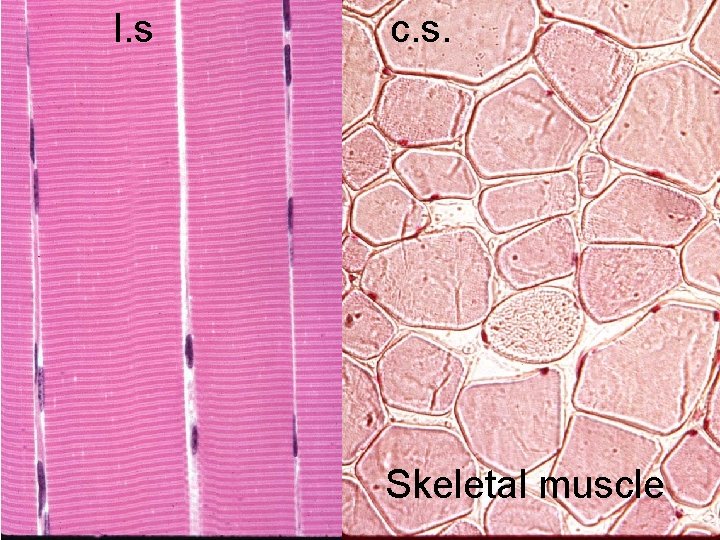 l. s c. s. Skeletal Muscle Skeletal muscle 
