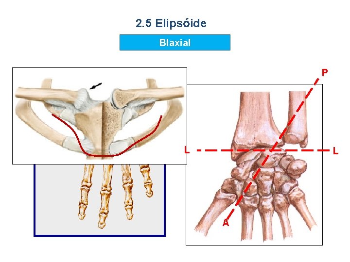 2. 5 Elipsóide BIaxial P L L A 