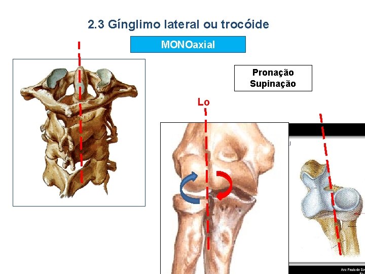 2. 3 Gínglimo lateral ou trocóide MONOaxial Pronação Supinação Lo 