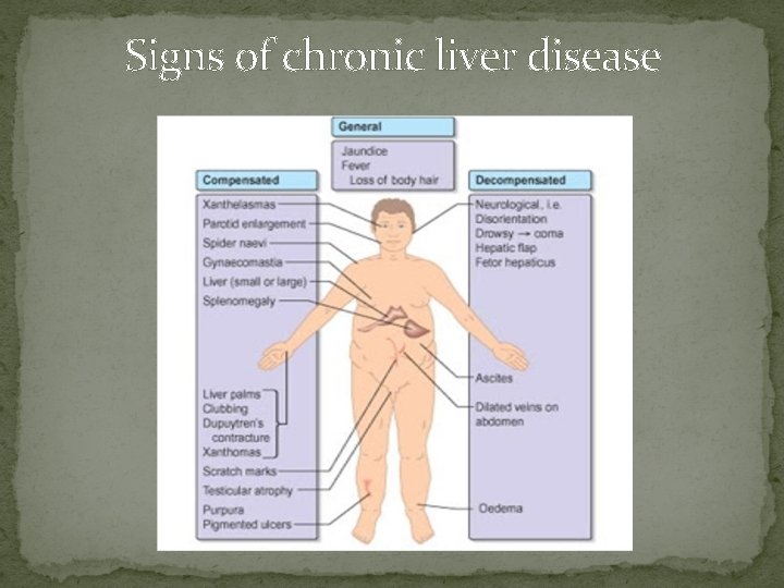 Signs of chronic liver disease 
