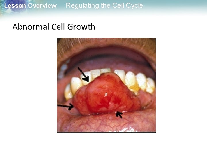 Lesson Overview Regulating the Cell Cycle Abnormal Cell Growth 