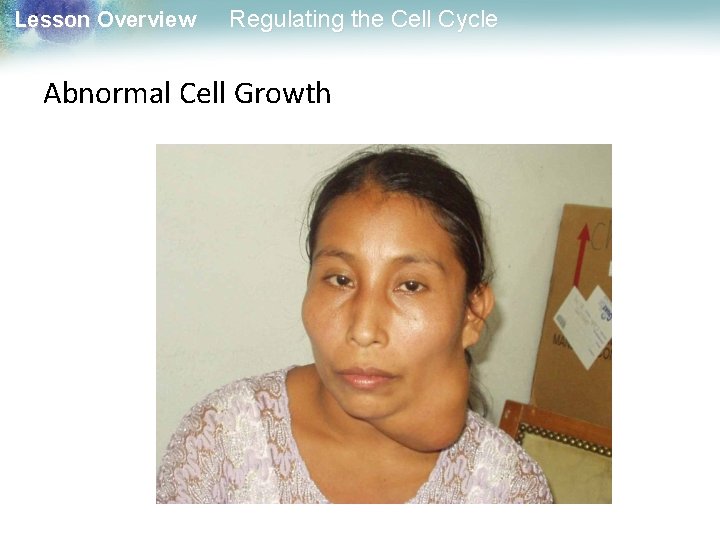 Lesson Overview Regulating the Cell Cycle Abnormal Cell Growth 