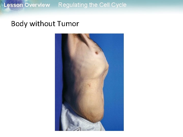 Lesson Overview Regulating the Cell Cycle Body without Tumor 