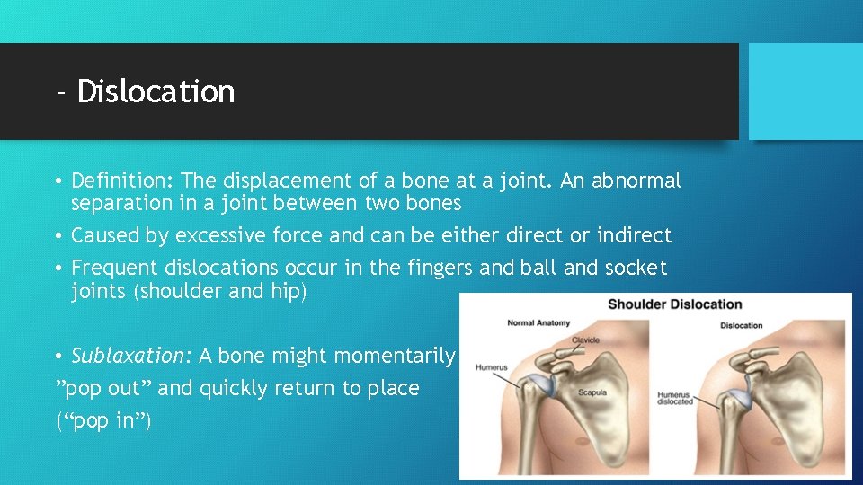 - Dislocation • Definition: The displacement of a bone at a joint. An abnormal