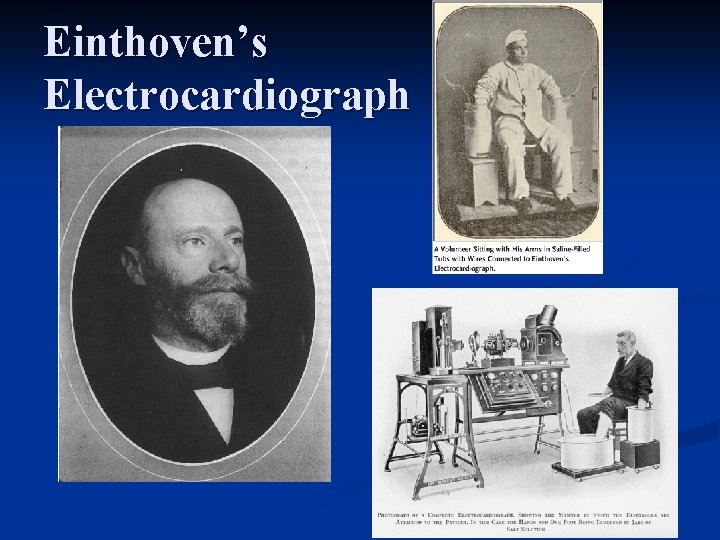 Einthoven’s Electrocardiograph 