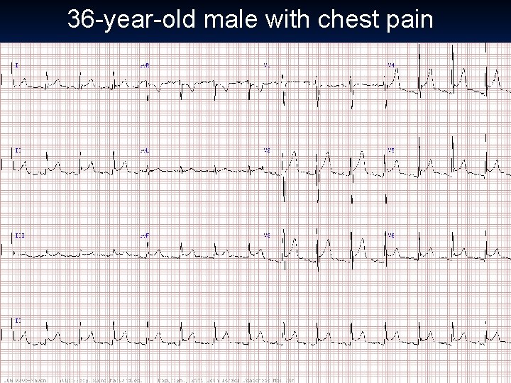 36 -year-old male with chest pain 