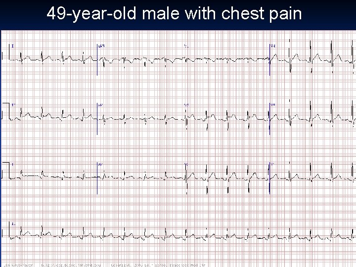 49 -year-old male with chest pain 