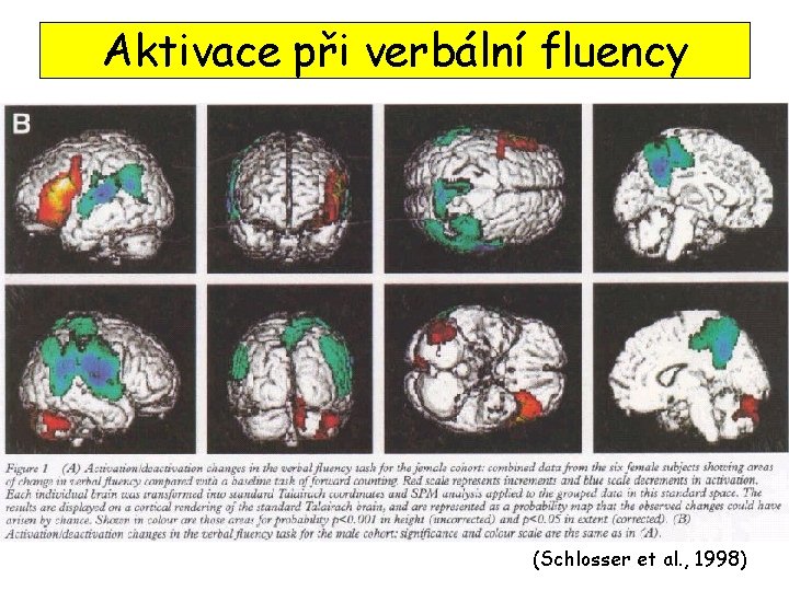Aktivace při verbální fluency (Schlosser et al. , 1998) 