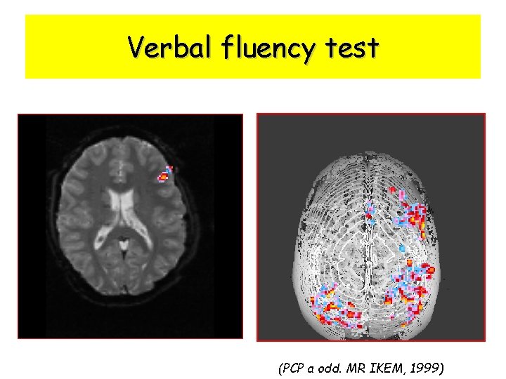 Verbal fluency test (PCP a odd. MR IKEM, 1999) 
