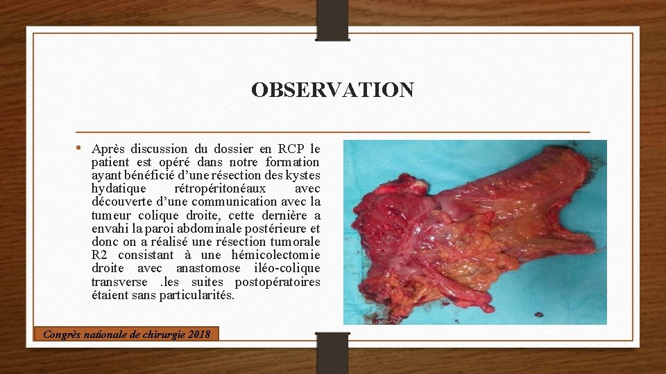 OBSERVATION • Après discussion du dossier en RCP le patient est opéré dans notre