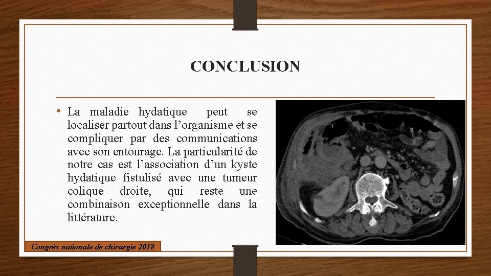 CONCLUSION • La maladie hydatique peut se localiser partout dans l’organisme et se compliquer
