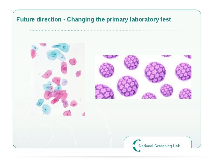 Future direction - Changing the primary laboratory test 