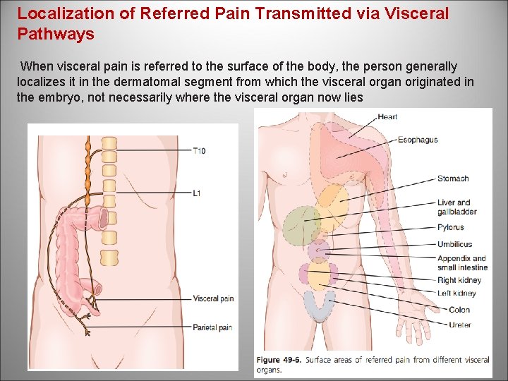Localization of Referred Pain Transmitted via Visceral Pathways When visceral pain is referred to