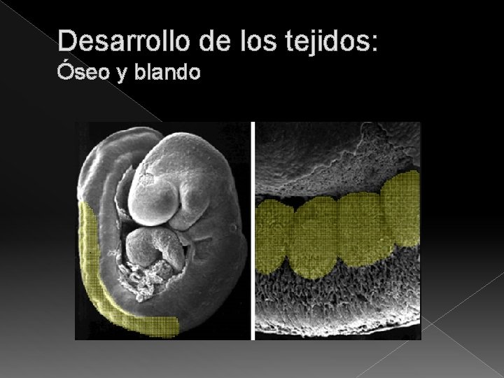 Desarrollo de los tejidos: Óseo y blando 