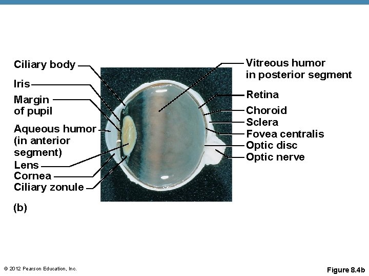 Ciliary body Iris Margin of pupil Aqueous humor (in anterior segment) Lens Cornea Ciliary Ciliary body Iris Margin of pupil Aqueous humor (in anterior segment) Lens Cornea Ciliary