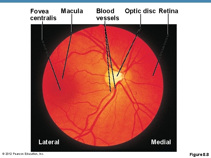Macula Fovea centralis Lateral © 2012 Pearson Education, Inc. Blood Optic disc Retina vessels Macula Fovea centralis Lateral © 2012 Pearson Education, Inc. Blood Optic disc Retina vessels