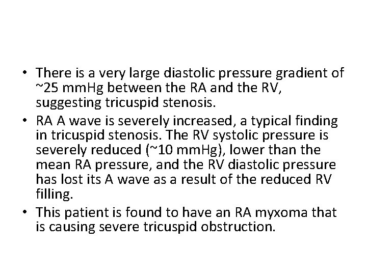  • There is a very large diastolic pressure gradient of ~25 mm. Hg