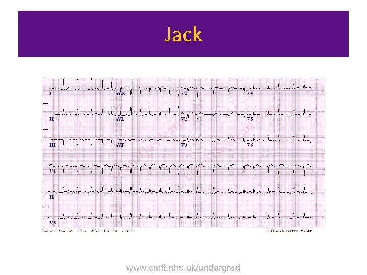 Jack www. cmft. nhs. uk/undergrad 