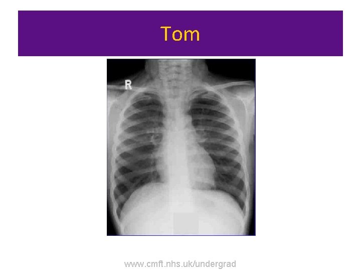 Tom www. cmft. nhs. uk/undergrad 