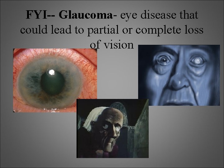 FYI-- Glaucoma- eye disease that could lead to partial or complete loss of vision