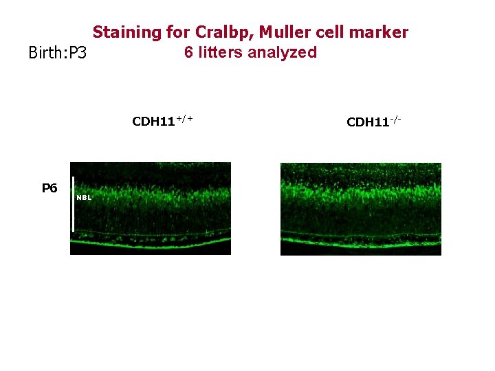 Staining for Cralbp, Muller cell marker 6 litters analyzed Birth: P 3 CDH 11+/+ Staining for Cralbp, Muller cell marker 6 litters analyzed Birth: P 3 CDH 11+/+