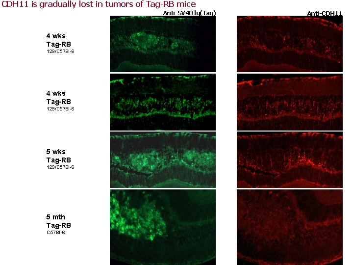 CDH 11 is gradually lost in tumors of Tag-RB mice Anti-SV 40 lg(Tag) 4 CDH 11 is gradually lost in tumors of Tag-RB mice Anti-SV 40 lg(Tag) 4