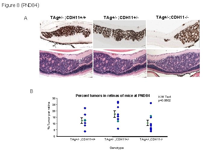 Figure 8 (PND 84) A TAg+/- ; CDH 11+/+ B % Tumor per retina Figure 8 (PND 84) A TAg+/- ; CDH 11+/+ B % Tumor per retina