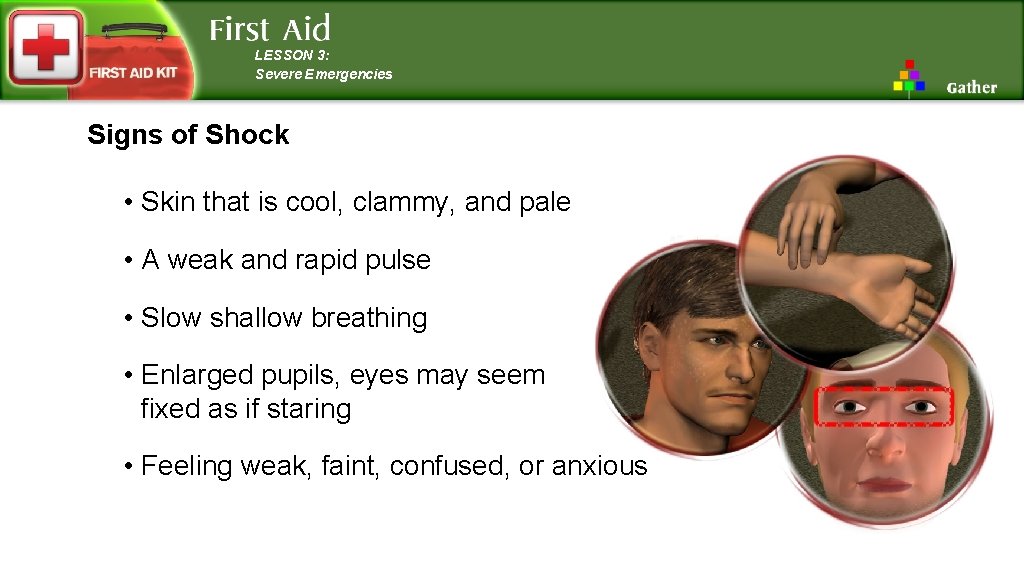 LESSON 3: Severe Emergencies Signs of Shock • Skin that is cool, clammy, and