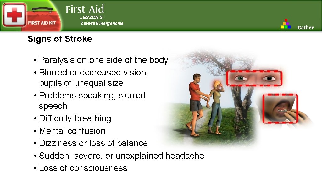 LESSON 3: Severe Emergencies Signs of Stroke • Paralysis on one side of the