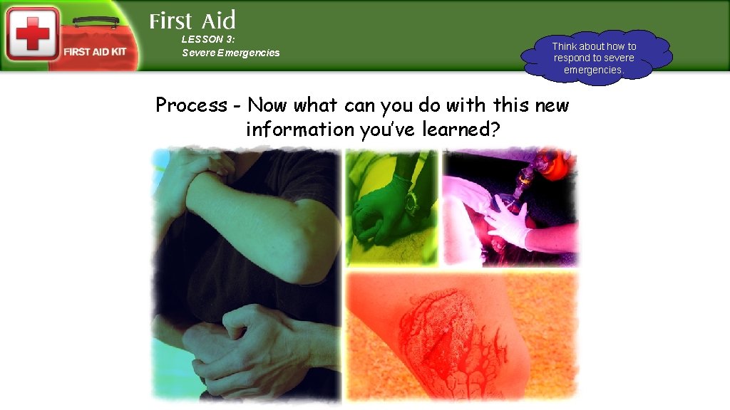 LESSON 3: Severe Emergencies Think about how to respond to severe emergencies. Process -