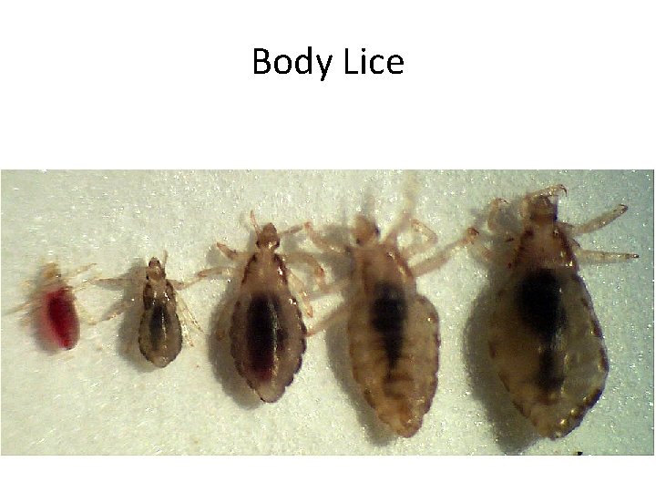 Body Lice 