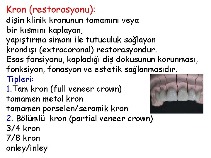 Kron (restorasyonu): dişin klinik kronunun tamamını veya bir kısmını kaplayan, yapıştırma simanı ile tutuculuk