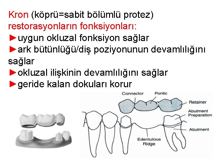 Kron (köprü=sabit bölümlü protez) restorasyonların fonksiyonları: ►uygun okluzal fonksiyon sağlar ►ark bütünlüğü/diş poziyonunun devamlılığını