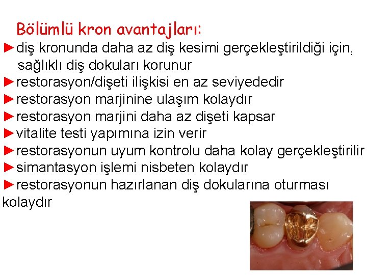 Bölümlü kron avantajları: ►diş kronunda daha az diş kesimi gerçekleştirildiği için, sağlıklı diş dokuları