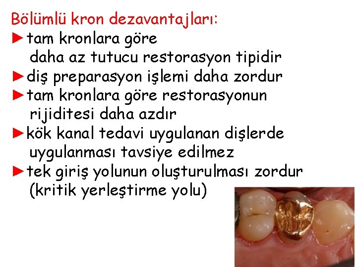 Bölümlü kron dezavantajları: ►tam kronlara göre daha az tutucu restorasyon tipidir ►diş preparasyon işlemi