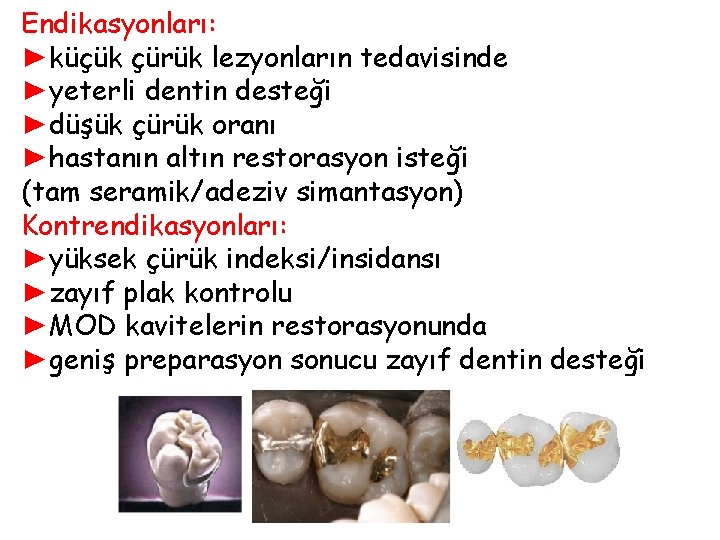 Endikasyonları: ►küçük çürük lezyonların tedavisinde ►yeterli dentin desteği ►düşük çürük oranı ►hastanın altın restorasyon