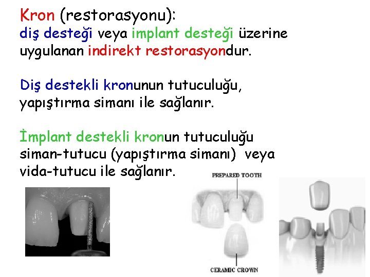 Kron (restorasyonu): diş desteği veya implant desteği üzerine uygulanan indirekt restorasyondur. Diş destekli kronunun