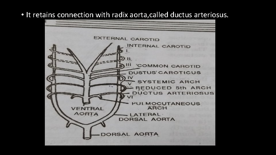  • It retains connection with radix aorta, called ductus arteriosus. 