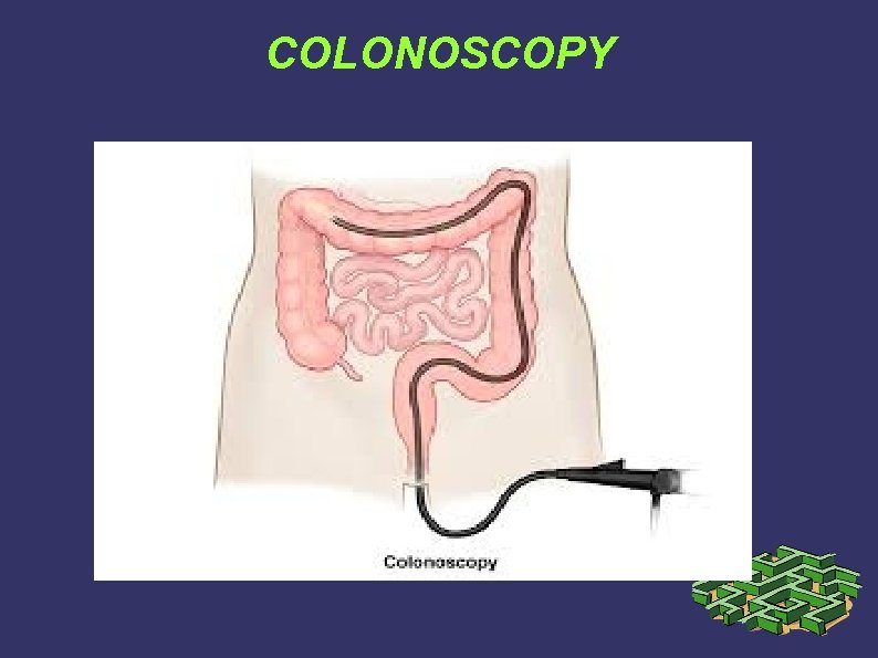 COLONOSCOPY COLONOSCOPY