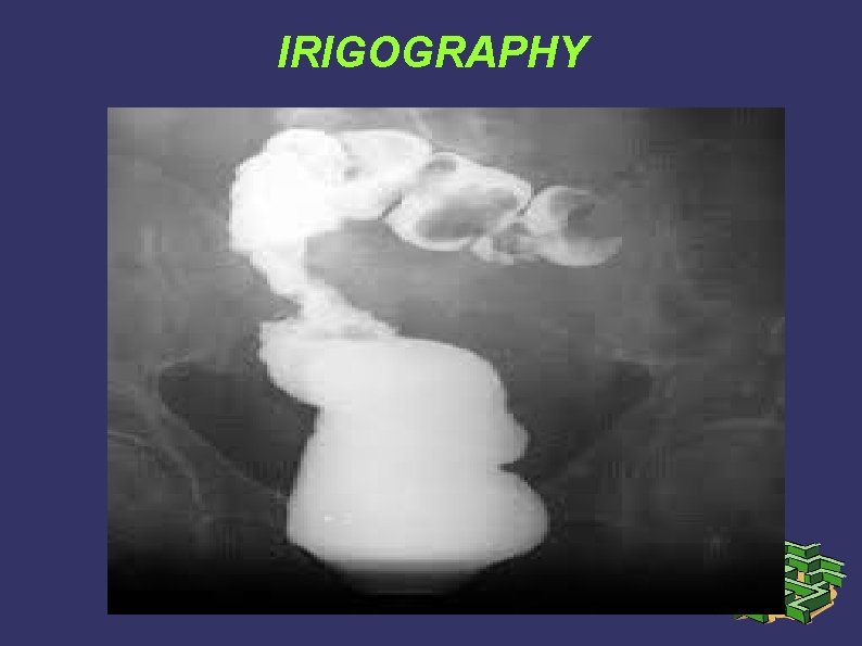 IRIGOGRAPHY IRIGOGRAPHY