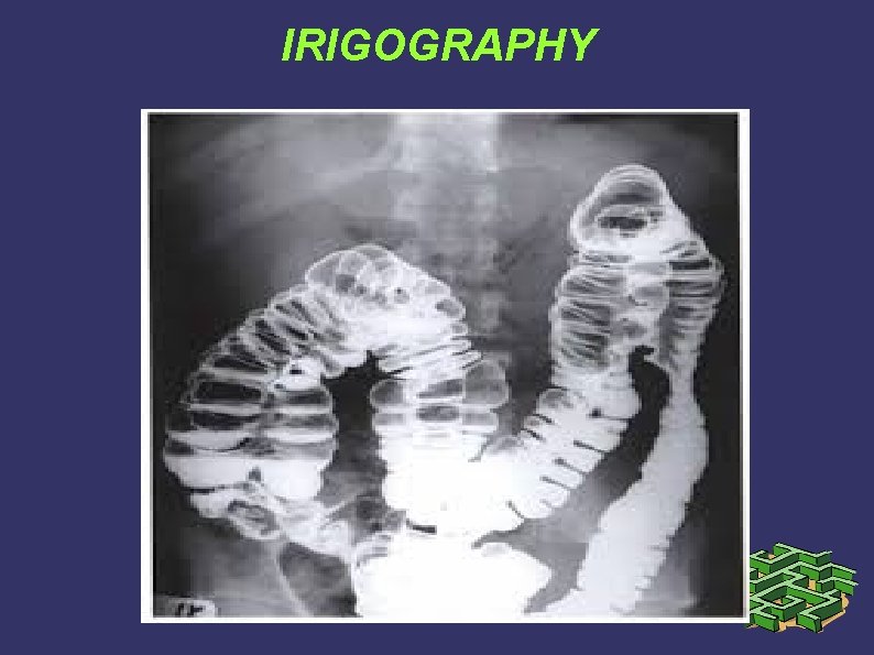 IRIGOGRAPHY IRIGOGRAPHY