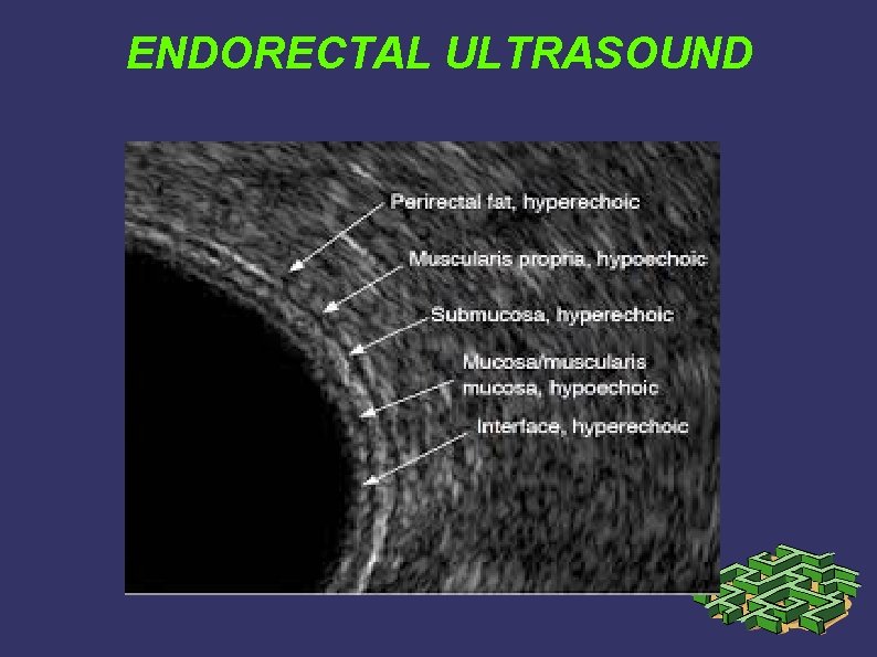 ENDORECTAL ULTRASOUND ENDORECTAL ULTRASOUND